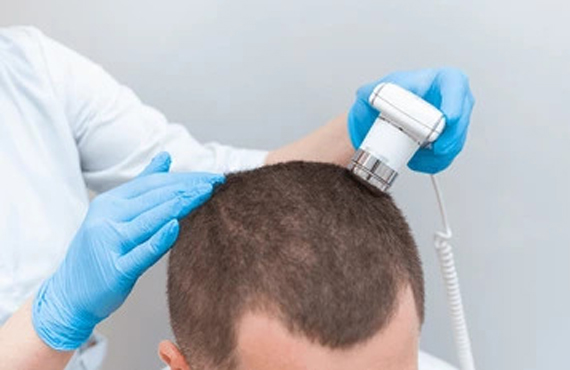 Hair Transplants Doctors in Guindy, Chennai